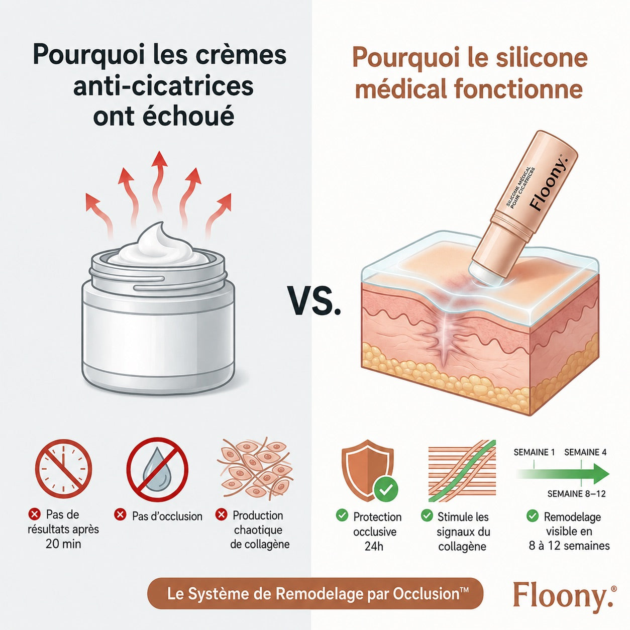 Avant et après l'amélioration des cicatrices d'acné avec Floony